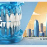 Dental‍‌‍‍‌‍‌‍‍‌ Implant in Gurgaon