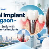 Dental Implant in Gurgaon